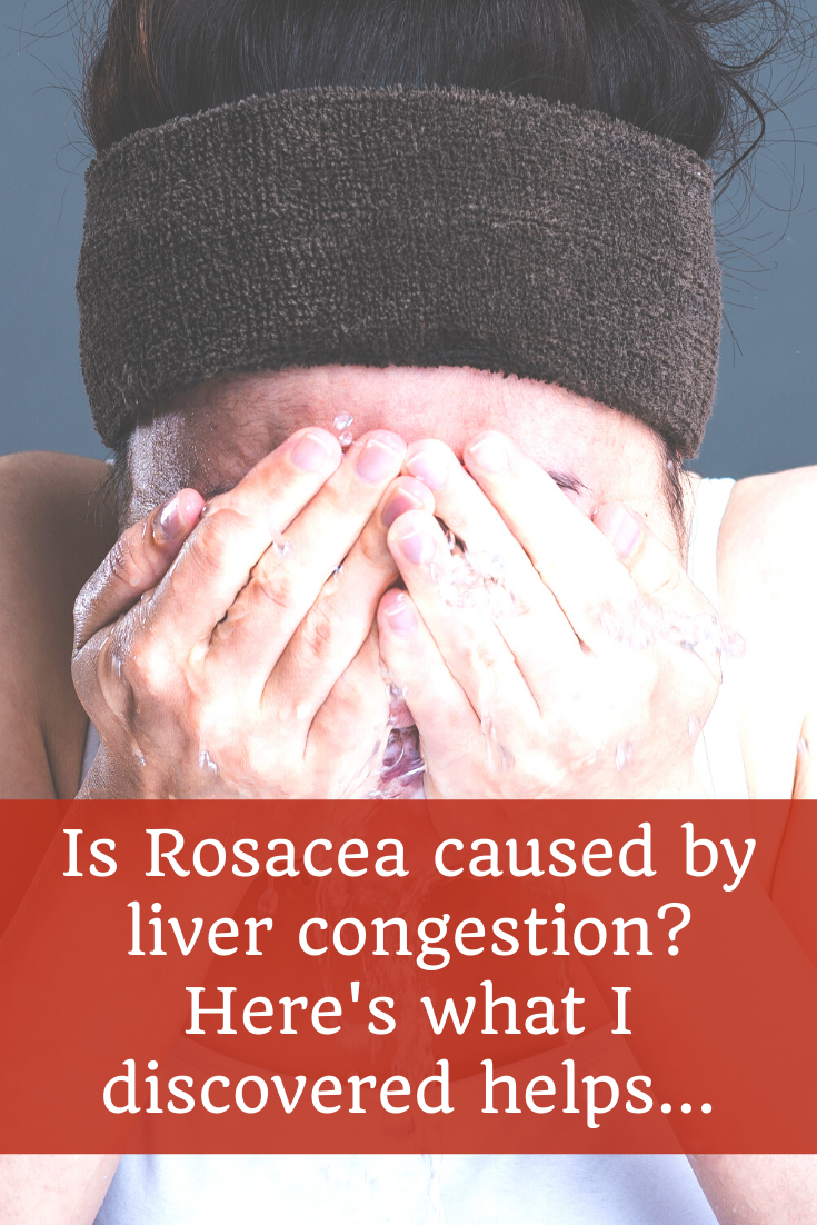 Is Rosacea caused by liver congestion... 4