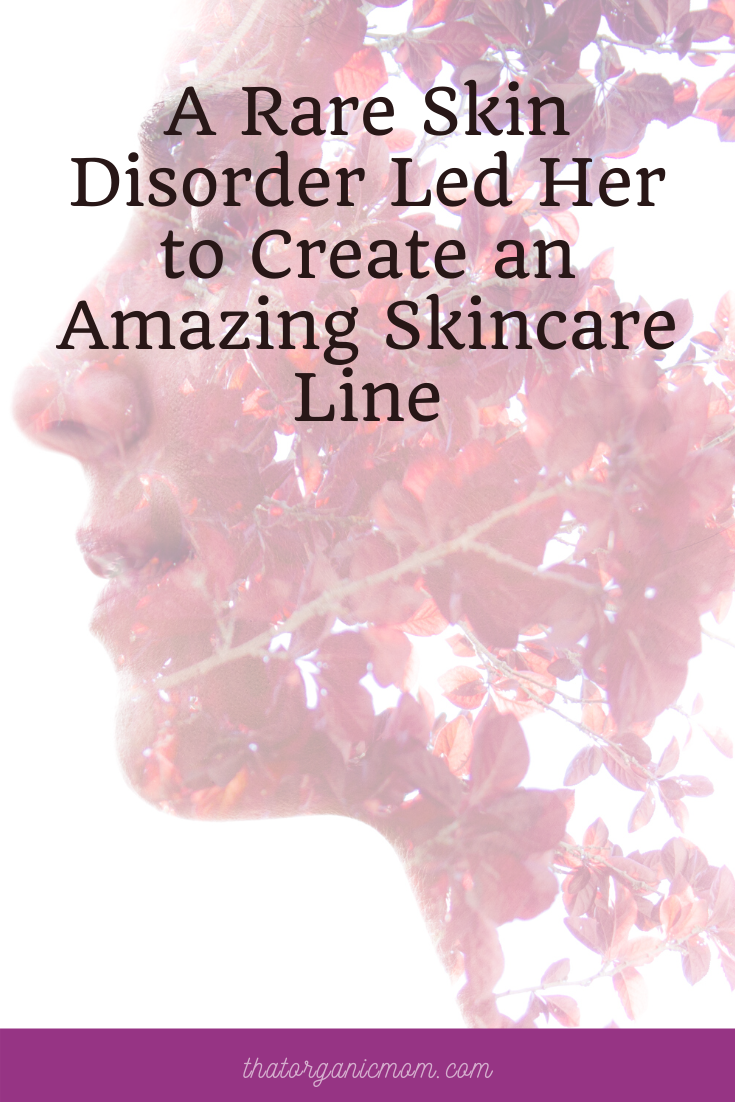 A Rare Skin Disorder Led Her to Create an Amazing Skincare Line 1